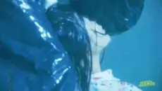 怀孕了还要整啊